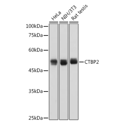 Western Blot - Anti-CTBP2 Antibody [ARC2509] (A308893) - Antibodies.com