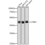 Western Blot - Anti-CTBP2 Antibody [ARC2509] (A308893) - Antibodies.com