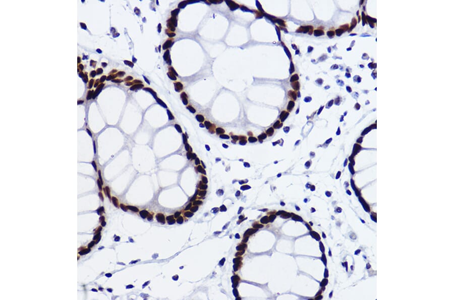 Immunohistochemistry - Anti-CTBP2 Antibody [ARC2509] (A308893) - Antibodies.com