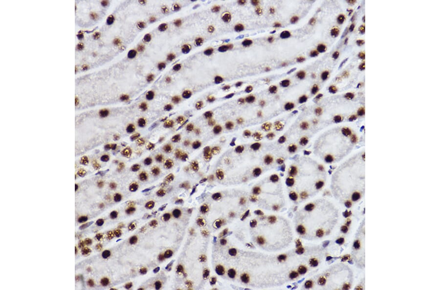 Immunohistochemistry - Anti-CTBP2 Antibody [ARC2509] (A308893) - Antibodies.com