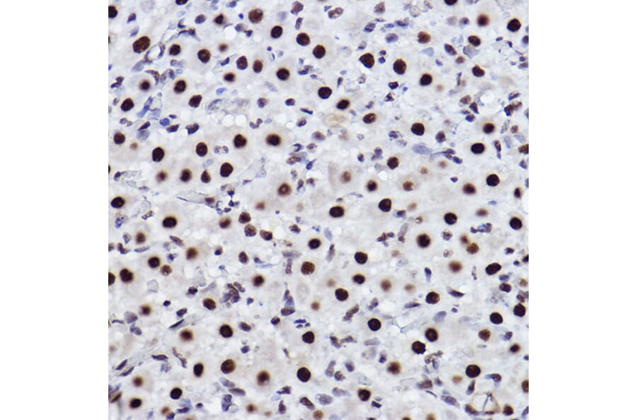 Immunohistochemistry - Anti-CTBP2 Antibody [ARC2509] (A308893) - Antibodies.com