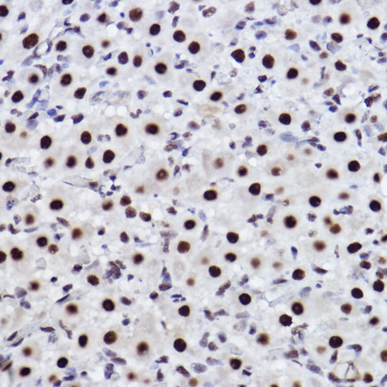 Immunohistochemistry - Anti-CTBP2 Antibody [ARC2509] (A308893) - Antibodies.com