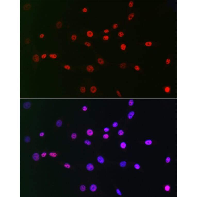 Immunofluorescence - Anti-CTBP2 Antibody [ARC2509] (A308893) - Antibodies.com