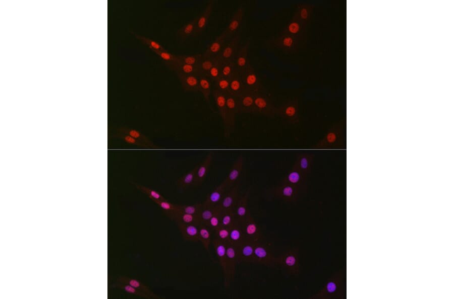 Immunofluorescence - Anti-CTBP2 Antibody [ARC2509] (A308893) - Antibodies.com