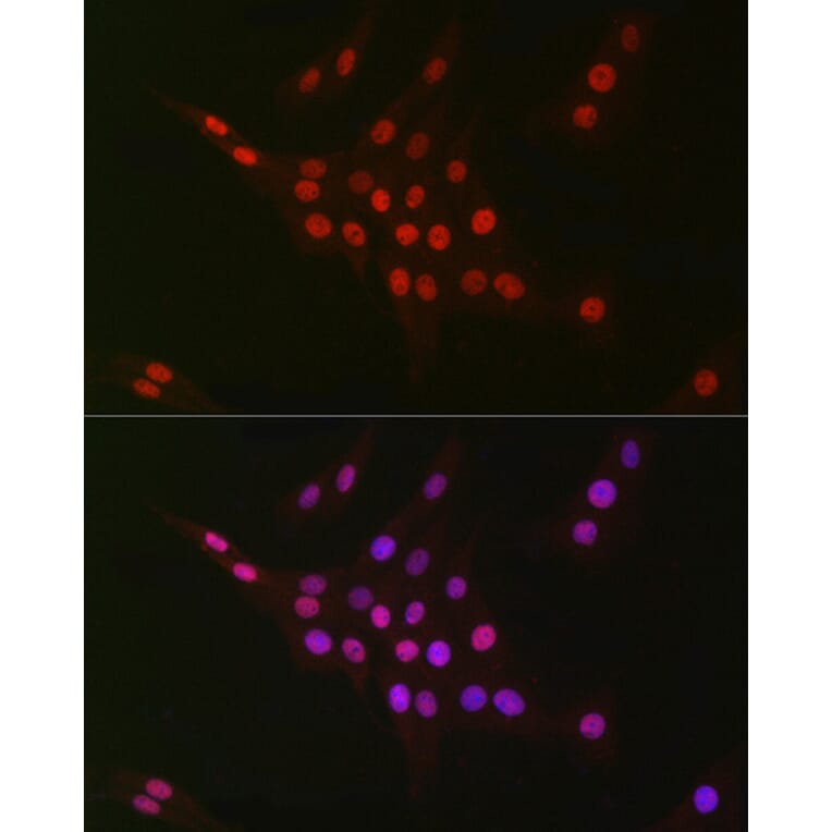 Immunofluorescence - Anti-CTBP2 Antibody [ARC2509] (A308893) - Antibodies.com
