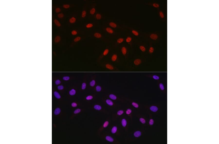 Immunofluorescence - Anti-CTBP2 Antibody [ARC2509] (A308893) - Antibodies.com