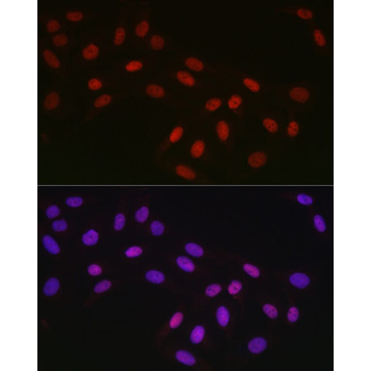 Immunofluorescence - Anti-CTBP2 Antibody [ARC2509] (A308893) - Antibodies.com