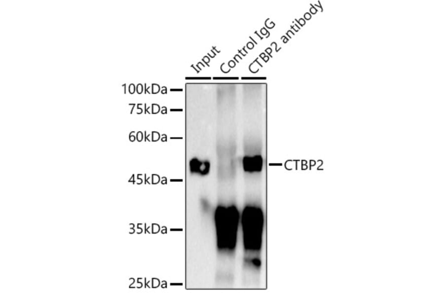 Western Blot - Anti-CTBP2 Antibody [ARC2509] (A308893) - Antibodies.com