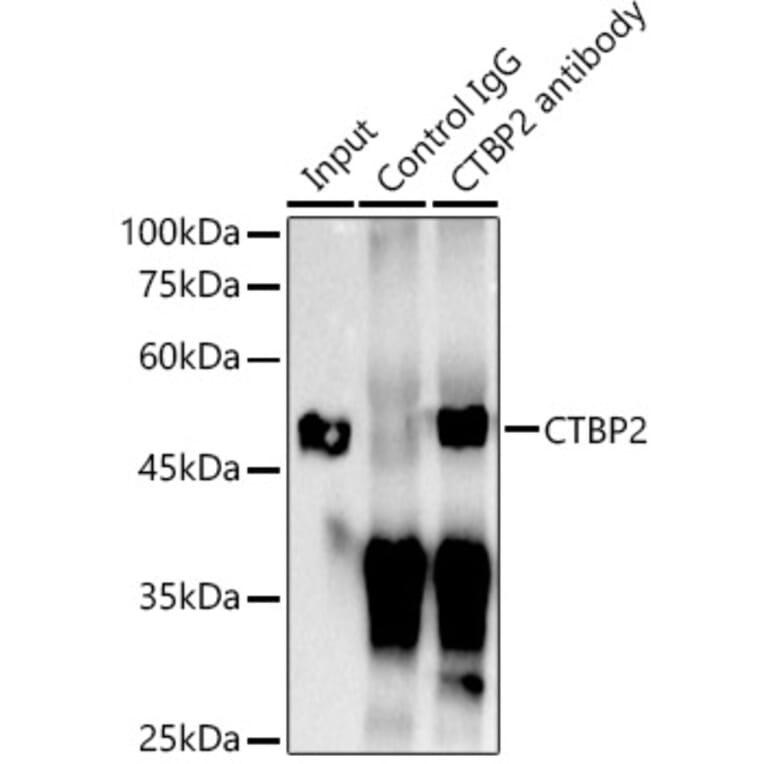 Western Blot - Anti-CTBP2 Antibody [ARC2509] (A308893) - Antibodies.com