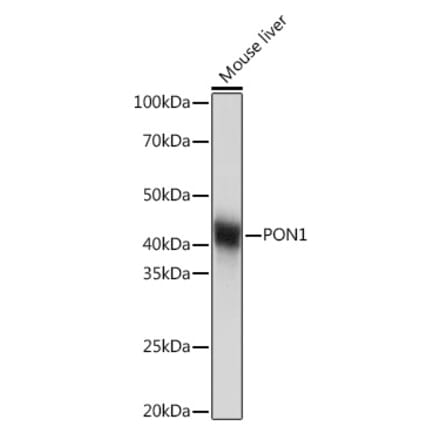 Western Blot - Anti-PON1 Antibody [ARC2001] (A308894) - Antibodies.com