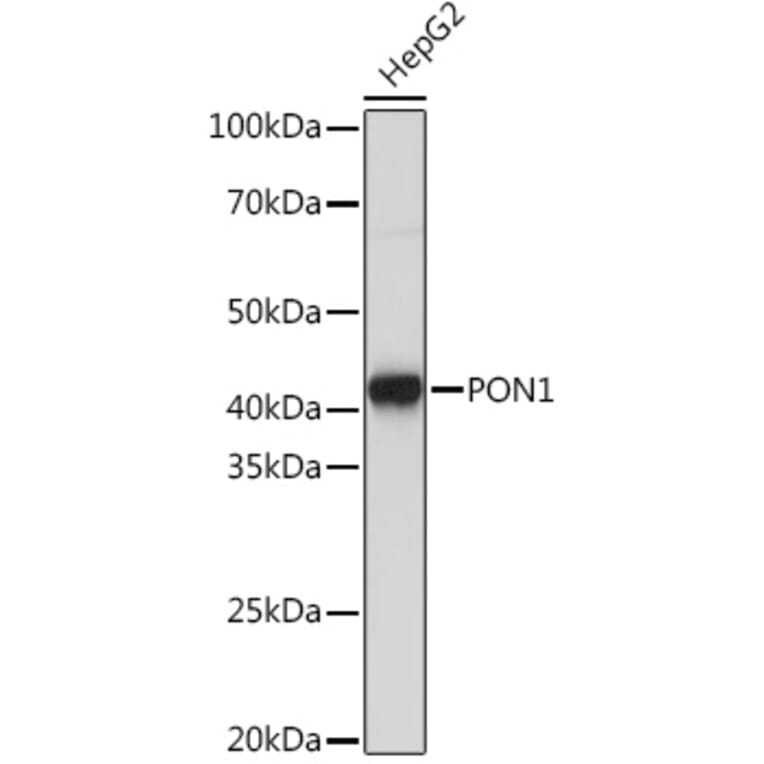 Western Blot - Anti-PON1 Antibody [ARC2001] (A308894) - Antibodies.com