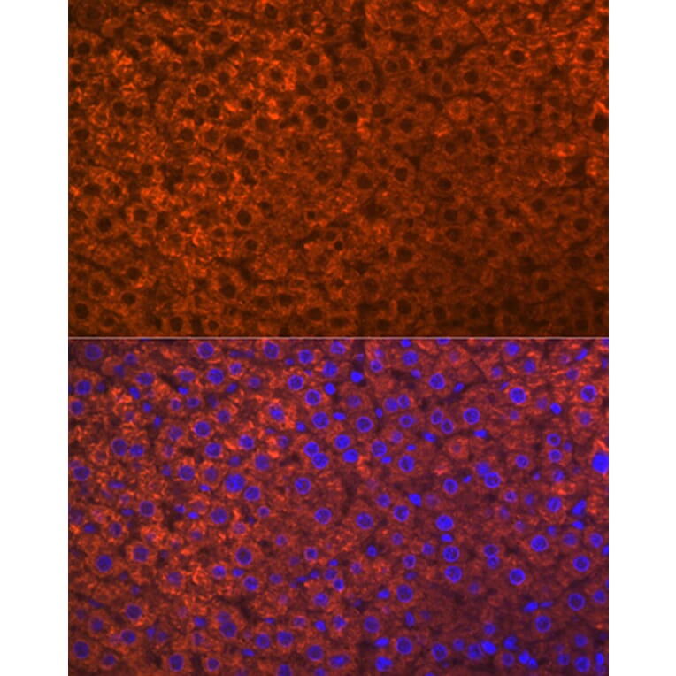 Immunofluorescence - Anti-PON1 Antibody [ARC2001] (A308894) - Antibodies.com