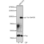 Western Blot - Anti-Tau (phospho Ser416) Antibody (A308895) - Antibodies.com