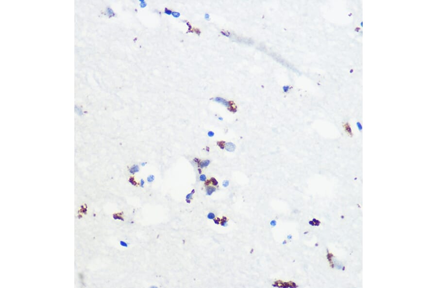 Immunohistochemistry - Anti-Tau (phospho Ser416) Antibody (A308895) - Antibodies.com