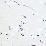 Immunohistochemistry - Anti-Tau (phospho Ser416) Antibody (A308895) - Antibodies.com