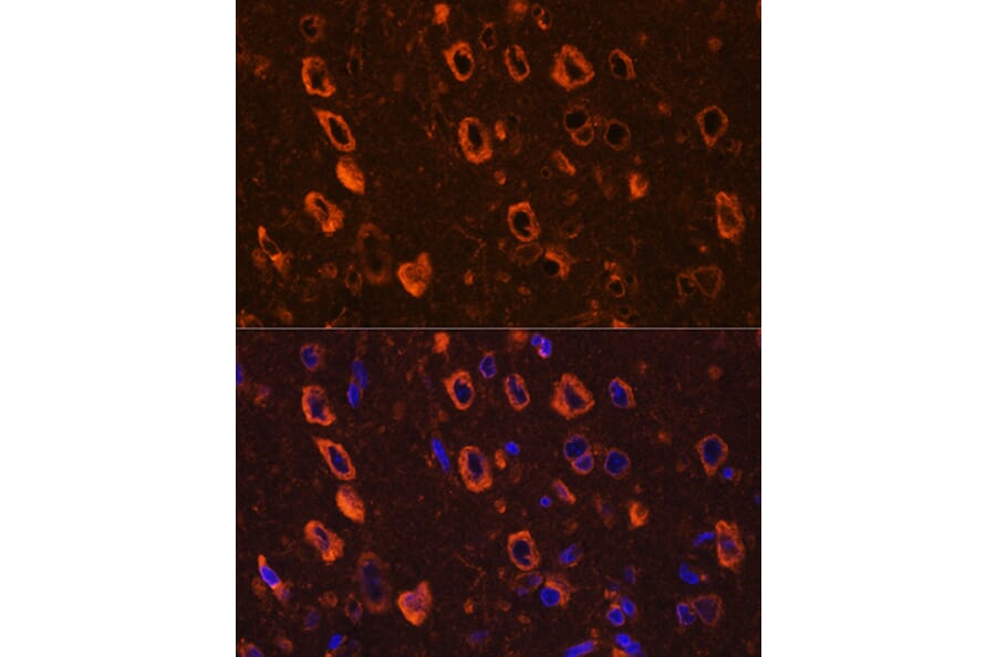 Immunofluorescence - Anti-Tau (phospho Ser416) Antibody (A308895) - Antibodies.com