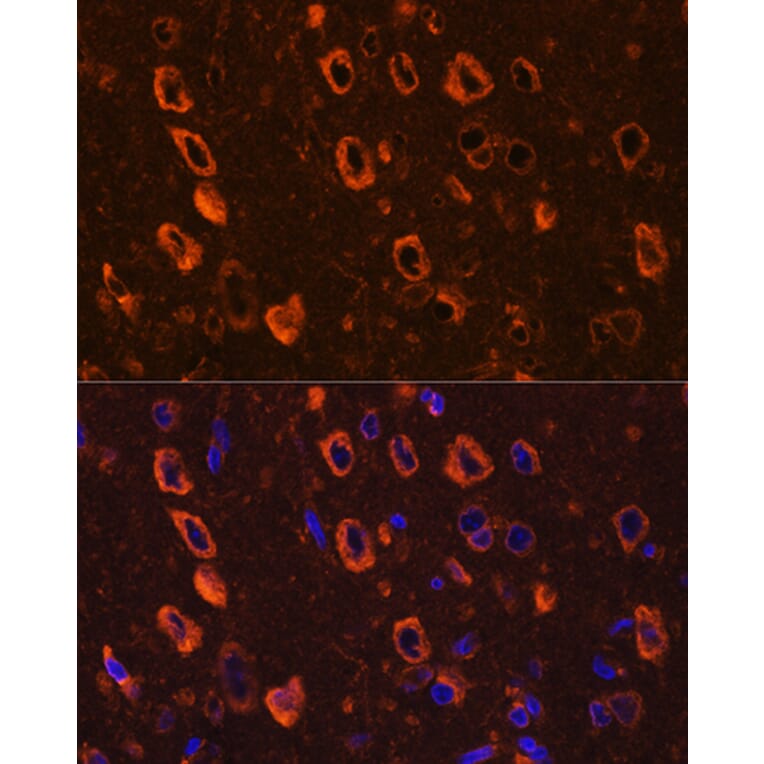 Immunofluorescence - Anti-Tau (phospho Ser416) Antibody (A308895) - Antibodies.com