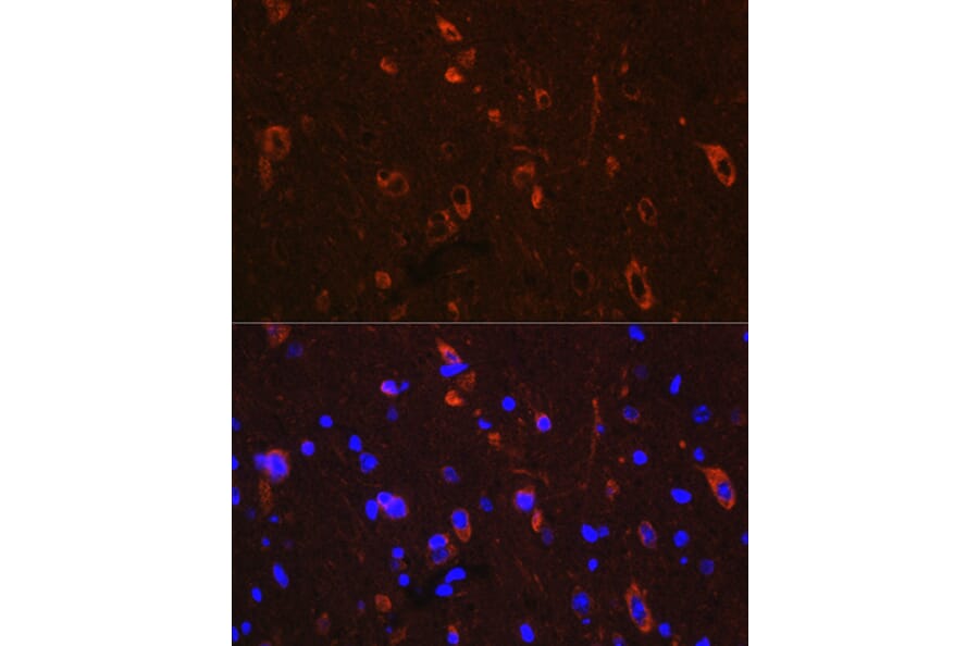 Immunofluorescence - Anti-Tau (phospho Ser416) Antibody (A308895) - Antibodies.com