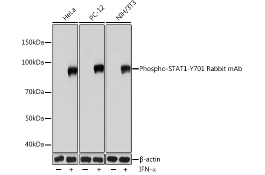 Western Blot - Anti-STAT1 (phospho Tyr701) Antibody [ARC0049] (A308896) - Antibodies.com