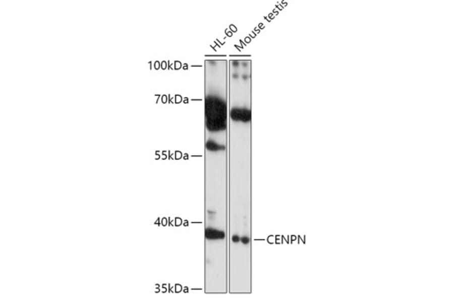 Western Blot - Anti-CENPN Antibody (A308898) - Antibodies.com