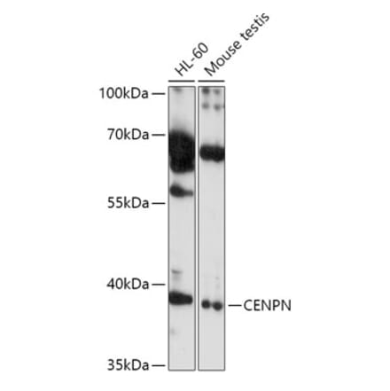 Western Blot - Anti-CENPN Antibody (A308898) - Antibodies.com