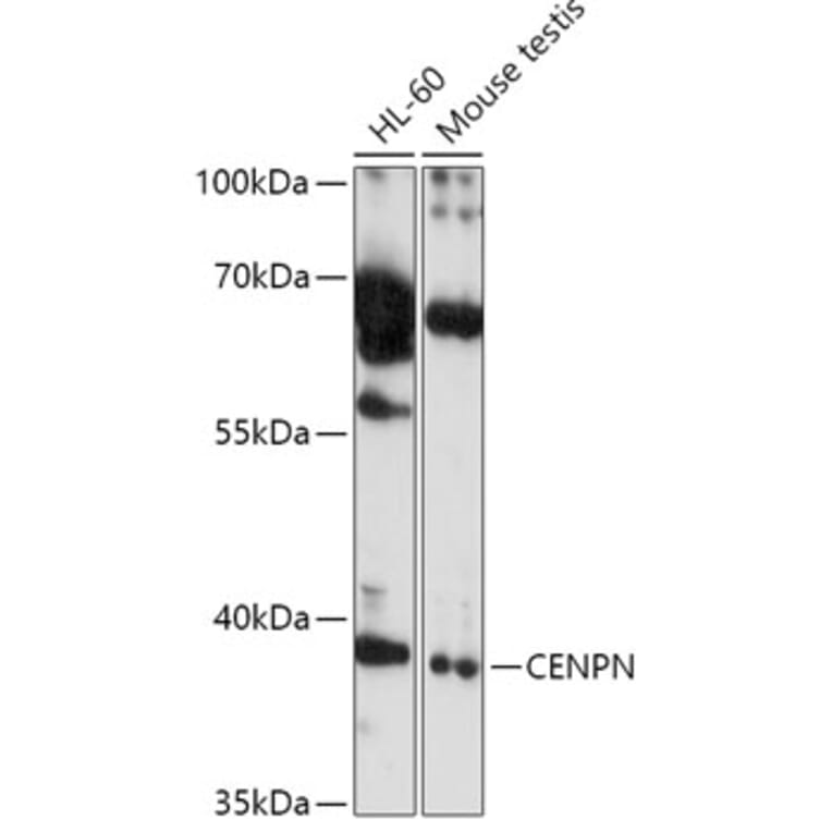 Western Blot - Anti-CENPN Antibody (A308898) - Antibodies.com