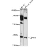 Western Blot - Anti-CENPN Antibody (A308898) - Antibodies.com