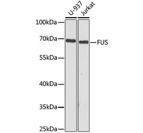 Western Blot - Anti-TLS/FUS Antibody (A308899) - Antibodies.com