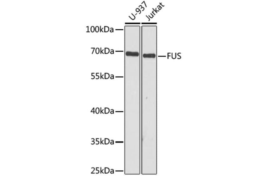 Western Blot - Anti-TLS/FUS Antibody (A308899) - Antibodies.com
