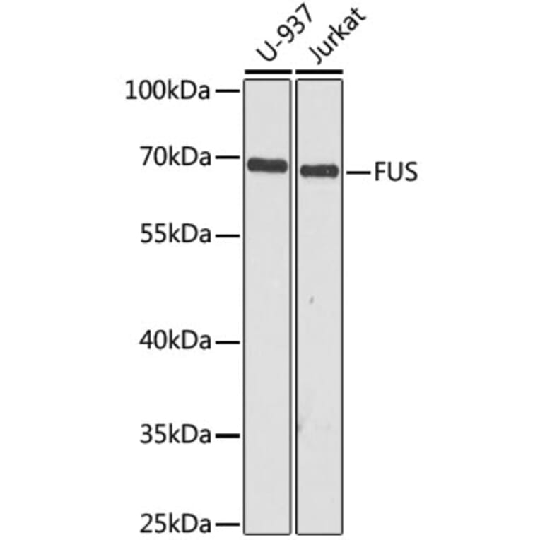 Western Blot - Anti-TLS/FUS Antibody (A308899) - Antibodies.com