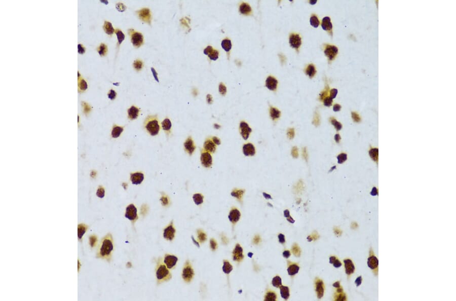 Immunohistochemistry - Anti-TLS/FUS Antibody (A308899) - Antibodies.com