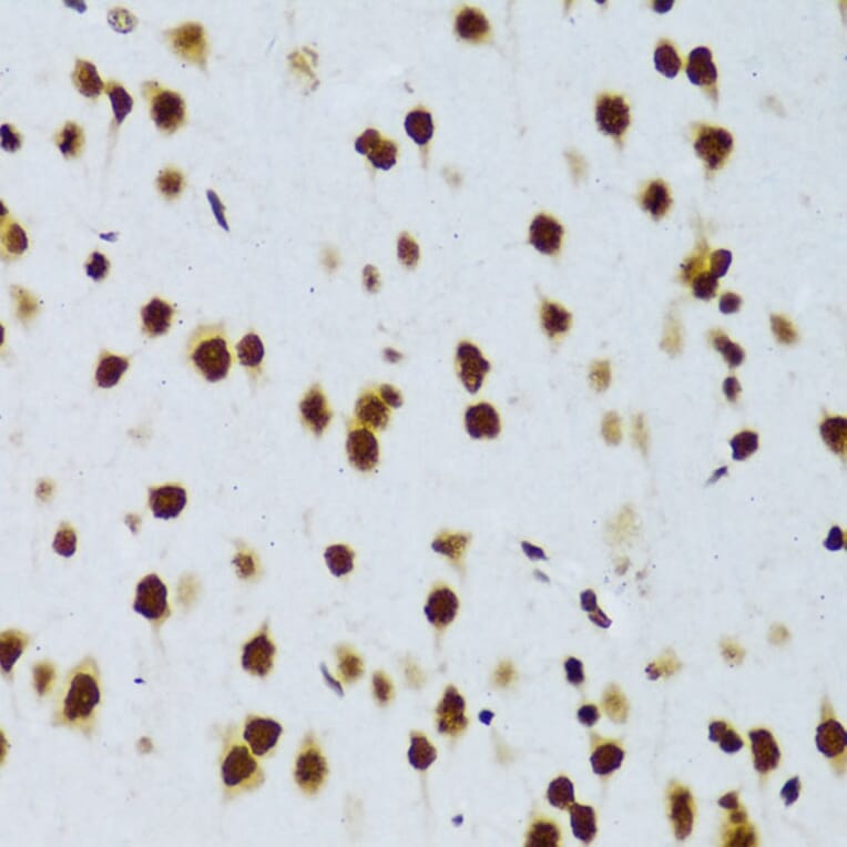 Immunohistochemistry - Anti-TLS/FUS Antibody (A308899) - Antibodies.com