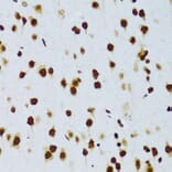 Immunohistochemistry - Anti-TLS/FUS Antibody (A308899) - Antibodies.com