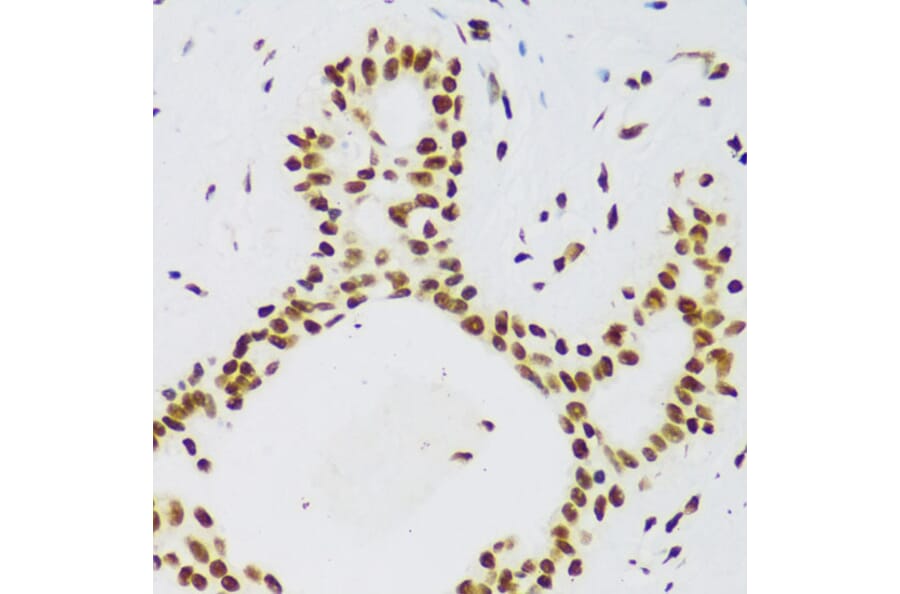 Immunohistochemistry - Anti-TLS/FUS Antibody (A308899) - Antibodies.com