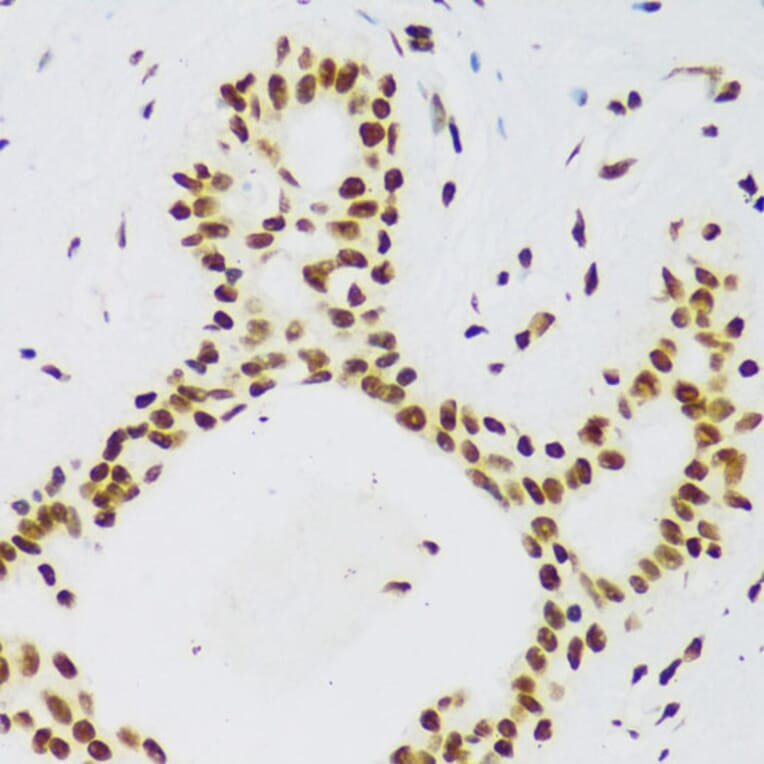 Immunohistochemistry - Anti-TLS/FUS Antibody (A308899) - Antibodies.com