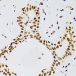 Immunohistochemistry - Anti-TLS/FUS Antibody (A308899) - Antibodies.com