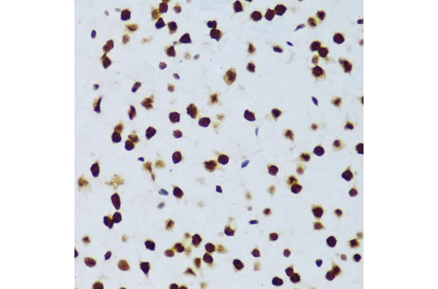 Immunohistochemistry - Anti-TLS/FUS Antibody (A308899) - Antibodies.com