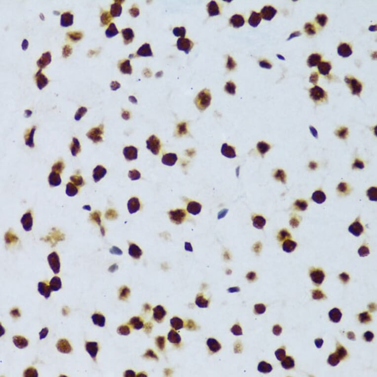 Immunohistochemistry - Anti-TLS/FUS Antibody (A308899) - Antibodies.com