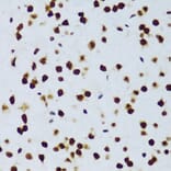 Immunohistochemistry - Anti-TLS/FUS Antibody (A308899) - Antibodies.com