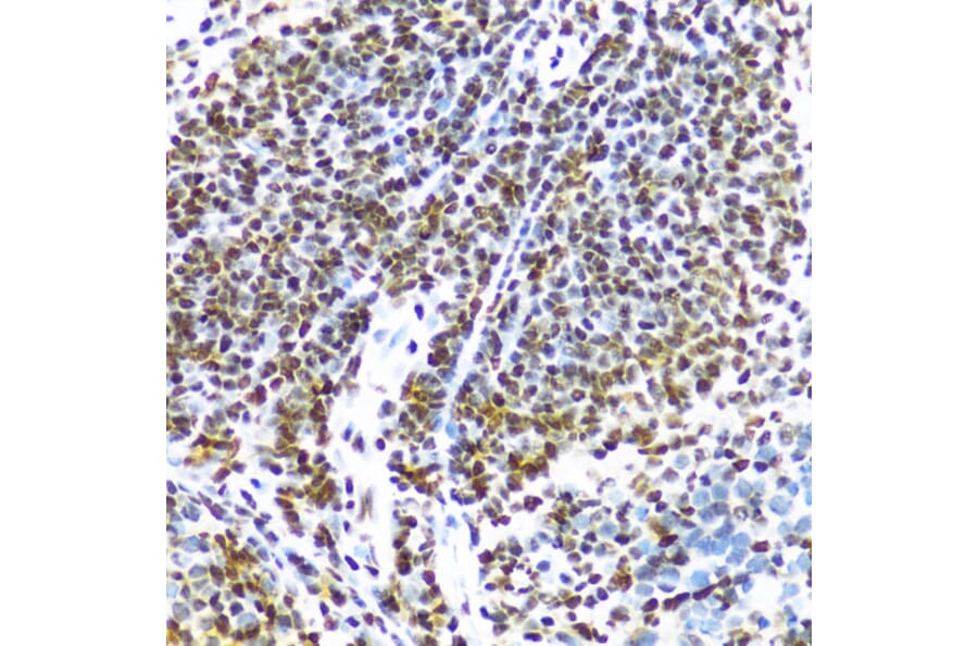 Immunohistochemistry - Anti-TLS/FUS Antibody (A308899) - Antibodies.com