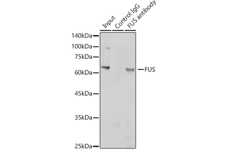 Western Blot - Anti-TLS/FUS Antibody (A308899) - Antibodies.com