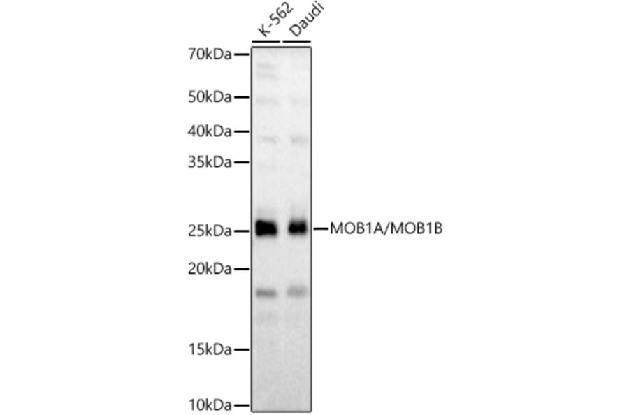 Western Blot - Anti-Mob1A Antibody (A308901) - Antibodies.com