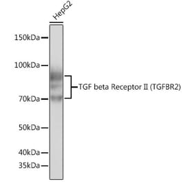 Western Blot - Anti-TGF beta Receptor II Antibody [ARC0407] (A308902) - Antibodies.com