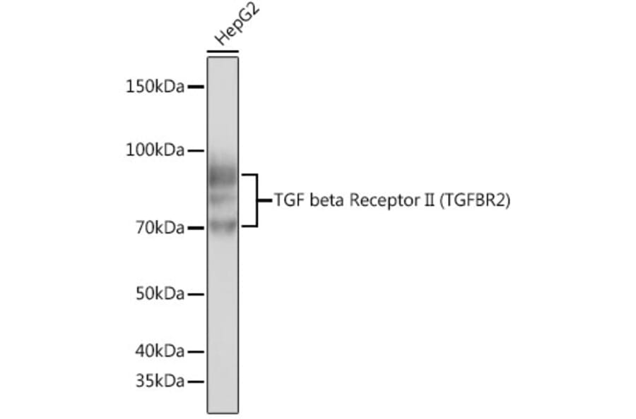 Western Blot - Anti-TGF beta Receptor II Antibody [ARC0407] (A308902) - Antibodies.com