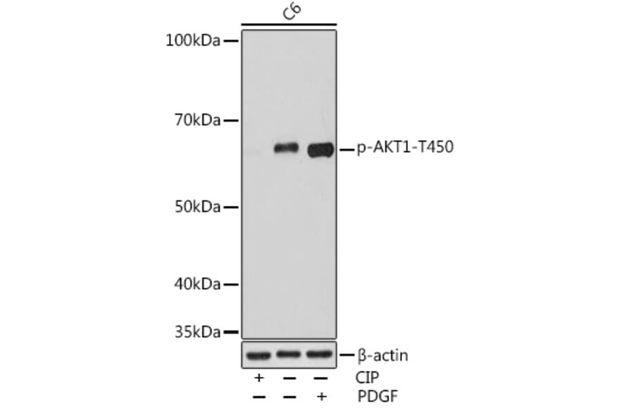 Western Blot - Anti-AKT1 (phospho Thr450) Antibody (A308903) - Antibodies.com