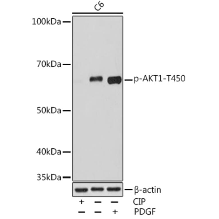 Western Blot - Anti-AKT1 (phospho Thr450) Antibody (A308903) - Antibodies.com