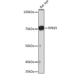 Western Blot - Anti-RPE65 Antibody [ARC1659] (A308904) - Antibodies.com