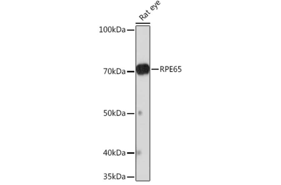 Western Blot - Anti-RPE65 Antibody [ARC1659] (A308904) - Antibodies.com