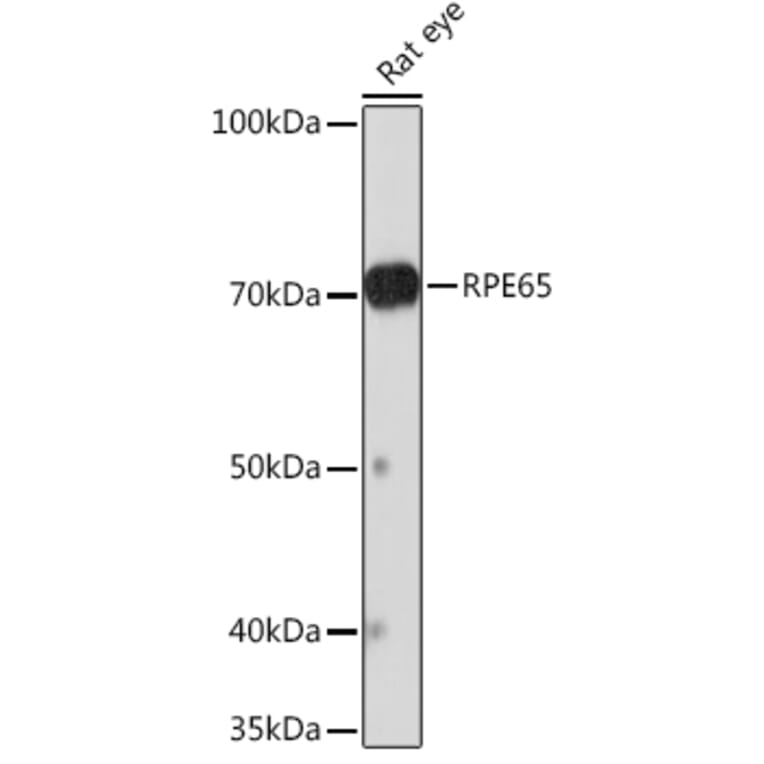 Western Blot - Anti-RPE65 Antibody [ARC1659] (A308904) - Antibodies.com