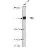 Western Blot - Anti-RPE65 Antibody [ARC1659] (A308904) - Antibodies.com